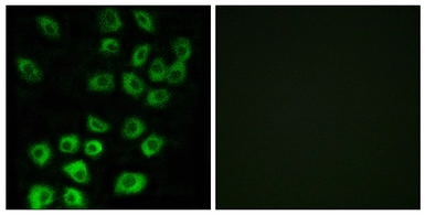Anti-ARFGAP1 antibody used in Immunocytochemistry/ Immunofluorescence (ICC/IF). GTX87479