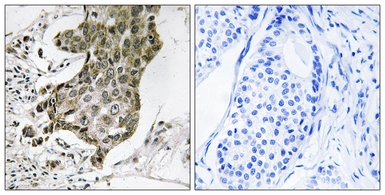Anti-RABEP1 antibody used in IHC (Paraffin sections) (IHC-P). GTX87480