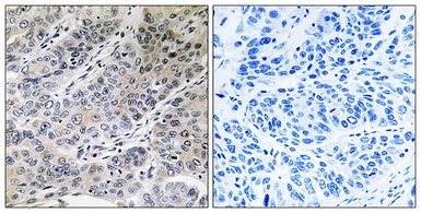 Anti-BRP44 antibody used in IHC (Paraffin sections) (IHC-P). GTX87481