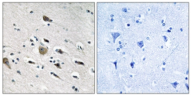 Anti-MRPL52 antibody used in IHC (Paraffin sections) (IHC-P). GTX87484