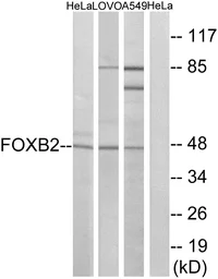 Anti-FOXB2 antibody used in Western Blot (WB). GTX87487