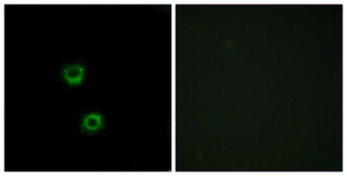 Anti-TMEM30C antibody used in Immunocytochemistry/ Immunofluorescence (ICC/IF). GTX87491