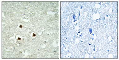 Anti-RAB3IP antibody used in IHC (Paraffin sections) (IHC-P). GTX87492