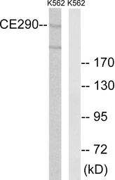 Anti-CEP290 antibody used in Western Blot (WB). GTX87497