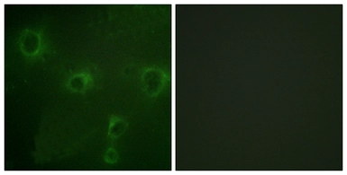 Anti-Kv2.1 antibody used in Immunocytochemistry/ Immunofluorescence (ICC/IF). GTX87498