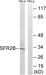 Anti-SFRS2B antibody used in Western Blot (WB). GTX87504