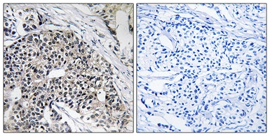 Anti-MRPL24 antibody used in IHC (Paraffin sections) (IHC-P). GTX87505