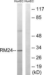 Anti-MRPL24 antibody used in Western Blot (WB). GTX87505