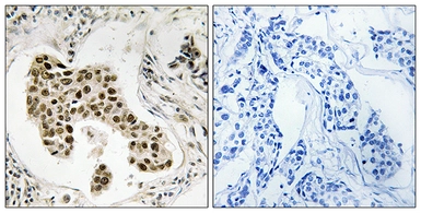 Anti-PMS2/PMS2CL antibody used in IHC (Paraffin sections) (IHC-P). GTX87509