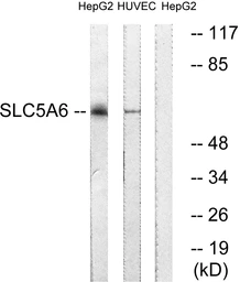 Anti-SLC5A6 antibody used in Western Blot (WB). GTX87516
