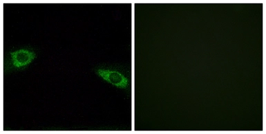 Anti-RPS4Y1 antibody used in Immunocytochemistry/ Immunofluorescence (ICC/IF). GTX87517