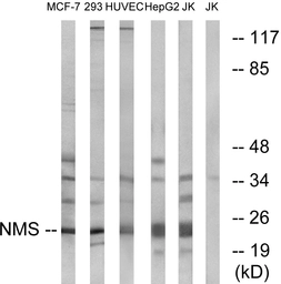Anti-NMS antibody used in Western Blot (WB). GTX87519