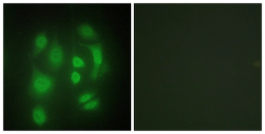 Anti-hnRNP Q antibody used in Immunocytochemistry/ Immunofluorescence (ICC/IF). GTX87520