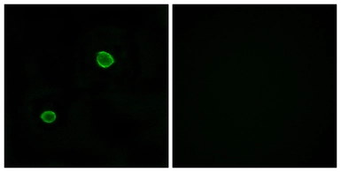 Anti-Apolipoprotein L4 antibody used in Immunocytochemistry/ Immunofluorescence (ICC/IF). GTX87523