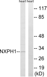 Anti-NXPH1 antibody used in Western Blot (WB). GTX87524