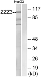 Anti-ZZZ3 antibody used in Western Blot (WB). GTX87527