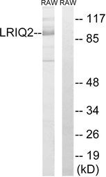 Anti-CEP97 antibody used in Western Blot (WB). GTX87528