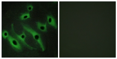 Anti-Her2 / ErbB2 antibody used in Immunocytochemistry/ Immunofluorescence (ICC/IF). GTX87531