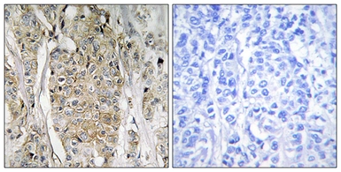 Anti-Her2 / ErbB2 antibody used in IHC (Paraffin sections) (IHC-P). GTX87531
