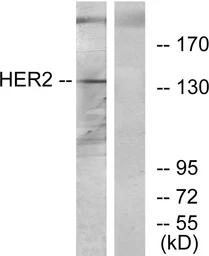 Anti-Her2 / ErbB2 antibody used in Western Blot (WB). GTX87531