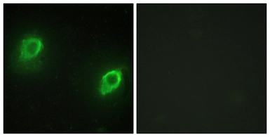 Anti-AKAP5 antibody used in Immunocytochemistry/ Immunofluorescence (ICC/IF). GTX87532