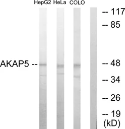 Anti-AKAP5 antibody used in Western Blot (WB). GTX87532