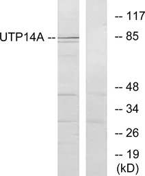 Anti-UTP14A antibody used in Western Blot (WB). GTX87543