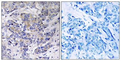 Anti-RPS21 antibody used in IHC (Paraffin sections) (IHC-P). GTX87545