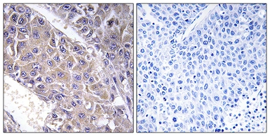 Anti-B4GALT3 antibody used in IHC (Paraffin sections) (IHC-P). GTX87547