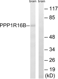 Anti-PPP1R16B antibody used in Western Blot (WB). GTX87549