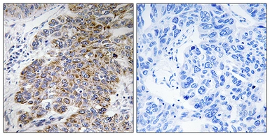 Anti-CHST10 antibody used in IHC (Paraffin sections) (IHC-P). GTX87551