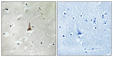 Anti-LRP10 antibody used in IHC (Paraffin sections) (IHC-P). GTX87552