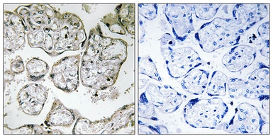 Anti-ME2 antibody used in IHC (Paraffin sections) (IHC-P). GTX87553
