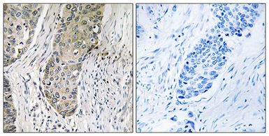 Anti-SIK3 antibody used in IHC (Paraffin sections) (IHC-P). GTX87554