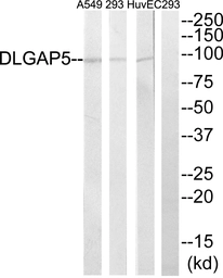Anti-HURP antibody used in Western Blot (WB). GTX87559