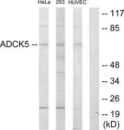 Anti-ADCK5 antibody used in Western Blot (WB). GTX87563