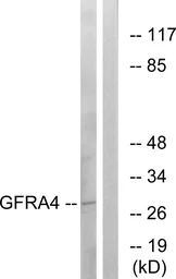 Anti-GFR alpha 4 antibody used in Western Blot (WB). GTX87564