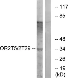Anti-OR2T5 + OR2T29 antibody used in Western Blot (WB). GTX87569