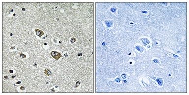 Anti-ZDHHC9 antibody used in IHC (Paraffin sections) (IHC-P). GTX87571