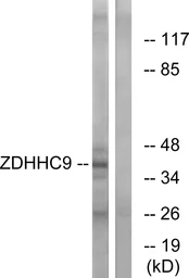 Anti-ZDHHC9 antibody used in Western Blot (WB). GTX87571