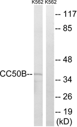 Anti-TMEM30B antibody used in Western Blot (WB). GTX87573