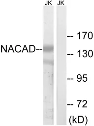 Anti-NACAD antibody used in Western Blot (WB). GTX87574
