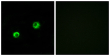 Anti-ARSI antibody used in Immunocytochemistry/ Immunofluorescence (ICC/IF). GTX87576