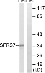 Anti-SFRS7 antibody used in Western Blot (WB). GTX87577
