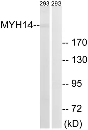 Anti-MYH14 antibody used in Western Blot (WB). GTX87578
