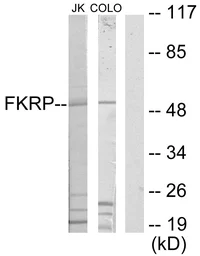 Anti-FKRP antibody used in Western Blot (WB). GTX87580