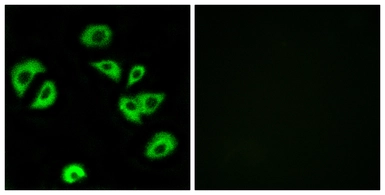 Anti-LILRB4 antibody used in Immunocytochemistry/ Immunofluorescence (ICC/IF). GTX87582