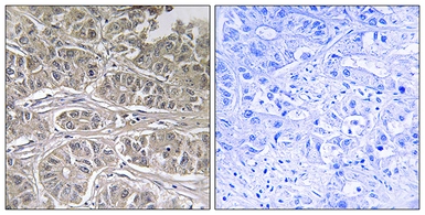 Anti-SLC25A21 antibody used in IHC (Paraffin sections) (IHC-P). GTX87583
