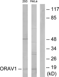 Anti-ORAV1 antibody used in Western Blot (WB). GTX87584