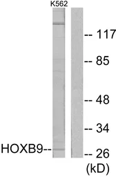 Anti-HOXB9 antibody used in Western Blot (WB). GTX87588